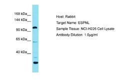 Espin-Like Protein Rabbit anti-Human, Polyclonal, Novus Biologicals 0.1 mL | Buy Online | Novus Biologicals | Fisher Scientific